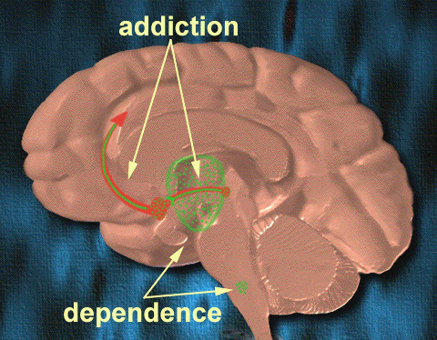 Addictiondependence