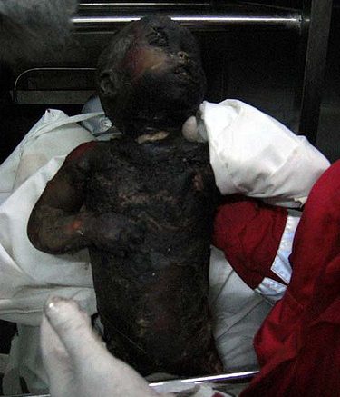 Infant victim, Gaza, palestinesi, israeliani